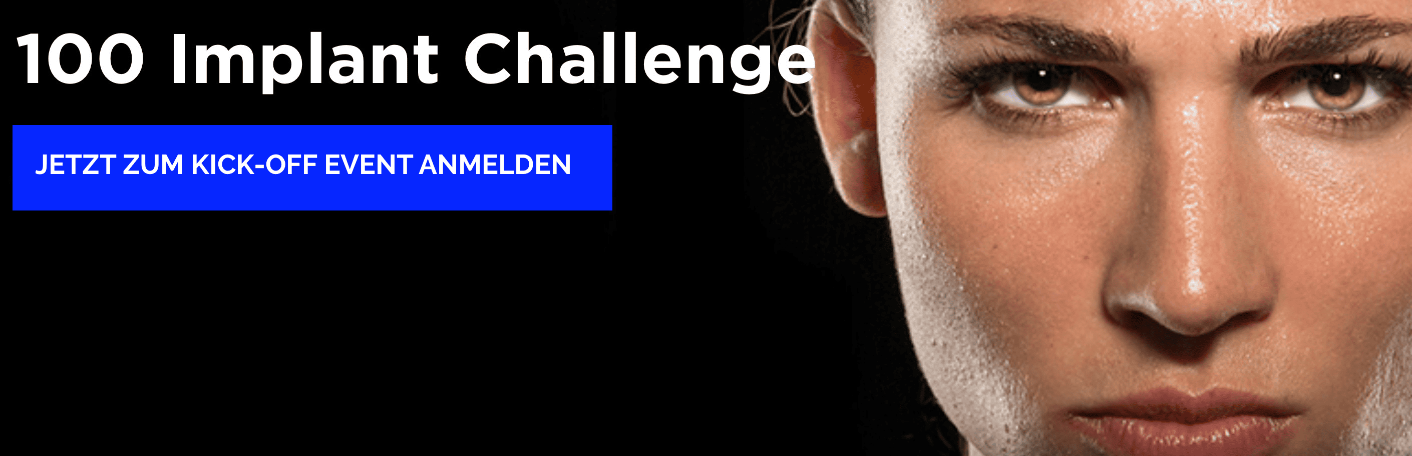 100 Implant Challenge @Hamburg