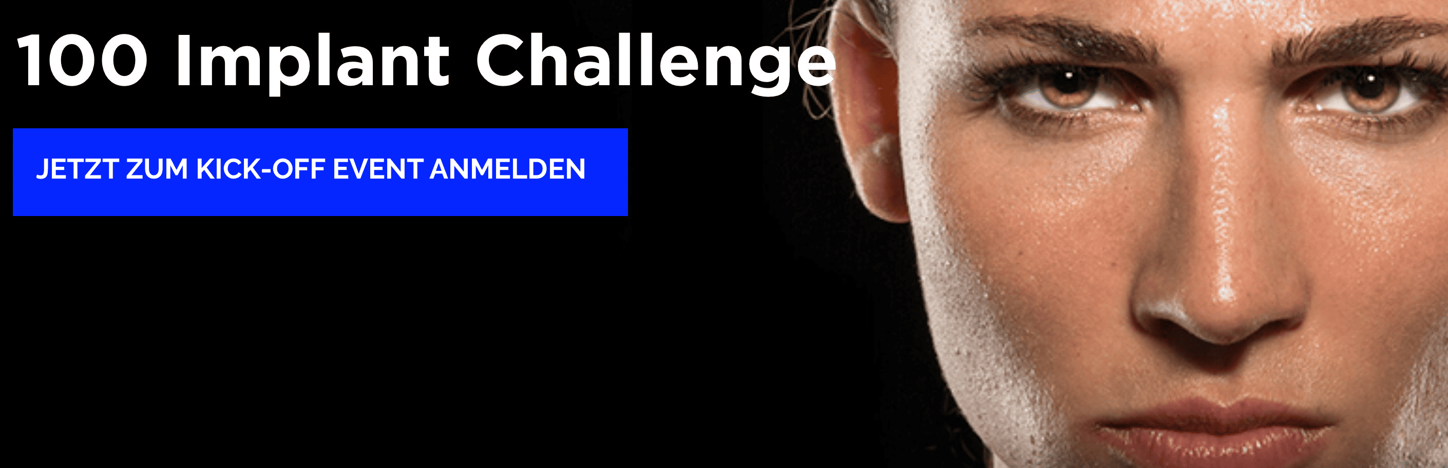 100 Implant Challenge @Köln